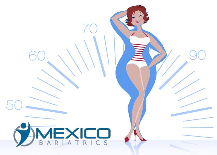 Mexico Bariatric Surgery Benefits