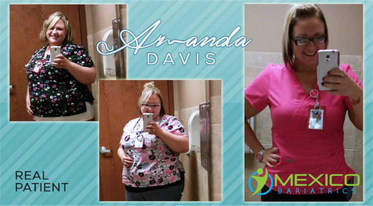 Why bariatric surgery? If you're thinking about weight loss surgery in Mexico, contact us about whether it is a good option for you.