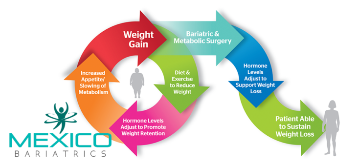 Once you have decided that having bariatric surgery is right for you, you will then need to select a facility and surgeon in Mexico.