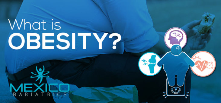 What is obesity? Everything you need to know about obesity, obesity prevention and bariatric surgery in Mexico.