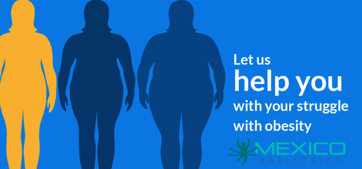 Bariatric surgery is a surgical option for losing weight in people who are extremely overweight and their weight poses a health hazard.