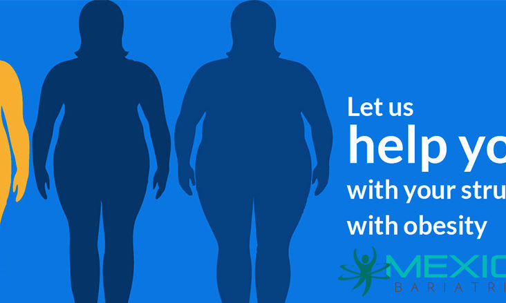 Bariatric surgery is a surgical option for losing weight in people who are extremely overweight and their weight poses a health hazard.