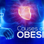 Obesity causes and health risks. Obesity is a medical condition due to the consumption of high calorie meals. Obesity is dependent on different factors.