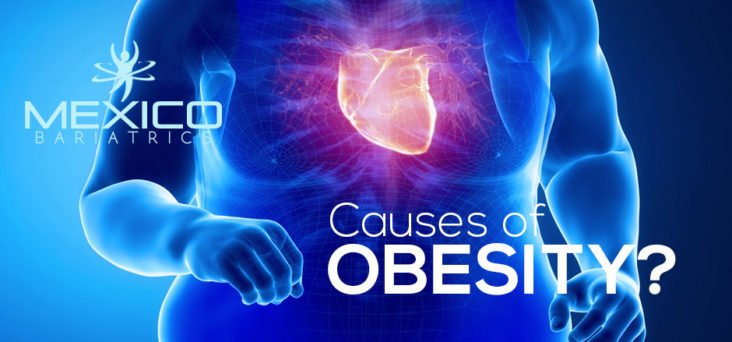 Obesity causes and health risks. Obesity is a medical condition due to the consumption of high calorie meals. Obesity is dependent on different factors.