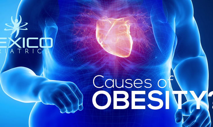 Obesity causes and health risks. Obesity is a medical condition due to the consumption of high calorie meals. Obesity is dependent on different factors.